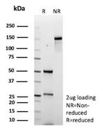 Fibroblast Activation Protein Alpha/FAP-1 Antibody in SDS-PAGE (SDS-PAGE)