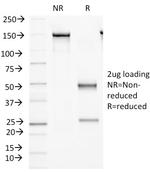 Protocadherin FAT2 (FAT Atypical Cadherin 2) Antibody in SDS-PAGE (SDS-PAGE)