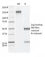 Fibrillin-1 (FBN1) (Marfan Syndrome Marker) Antibody in SDS-PAGE (SDS-PAGE)