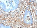 Fibrillin-1 (FBN1) (Marfan Syndrome Marker) Antibody in Immunohistochemistry (Paraffin) (IHC (P))