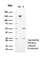 Fibrillin-1 (FBN1) (Marfan Syndrome Marker) Antibody in SDS-PAGE (SDS-PAGE)