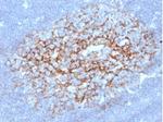 CD23 (Fc Epsilon RII) Antibody in Immunohistochemistry (Paraffin) (IHC (P))