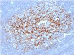 CD23 (Fc Epsilon RII) Antibody in Immunohistochemistry (Paraffin) (IHC (P))