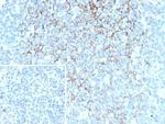 CD23 (Fc Epsilon RII) Antibody in Immunohistochemistry (Paraffin) (IHC (P))