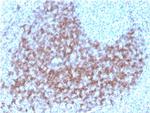 CD23 (Fc Epsilon RII) Antibody in Immunohistochemistry (Paraffin) (IHC (P))