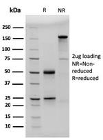 CD23 (Fc Epsilon RII) Antibody in SDS-PAGE (SDS-PAGE)