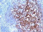 CD23 (Fc Epsilon RII) Antibody in Immunohistochemistry (Paraffin) (IHC (P))