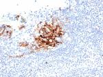 CD23 (Fc Epsilon RII) Antibody in Immunohistochemistry (Paraffin) (IHC (P))