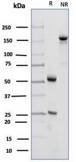 CD23 (Fc Epsilon RII) Antibody in SDS-PAGE (SDS-PAGE)