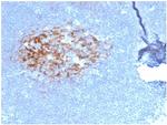 CD23 (Fc Epsilon RII) Antibody in Immunohistochemistry (Paraffin) (IHC (P))