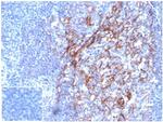 CD23 (Fc Epsilon RII) Antibody in Immunohistochemistry (Paraffin) (IHC (P))