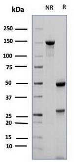 CD23 (Fc Epsilon RII) Antibody in SDS-PAGE (SDS-PAGE)