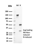 CD23 (Fc Epsilon RII) Antibody in SDS-PAGE (SDS-PAGE)