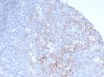 CD23 (Fc Epsilon RII) Antibody in Immunohistochemistry (Paraffin) (IHC (P))