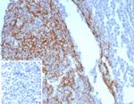 CD23 (Fc Epsilon RII) Antibody in Immunohistochemistry (Paraffin) (IHC (P))