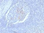 CD23 (Fc Epsilon RII) Antibody in Immunohistochemistry (Paraffin) (IHC (P))