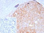 CD23 (Fc Epsilon RII) Antibody in Immunohistochemistry (Paraffin) (IHC (P))