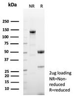 CD23 (Fc Epsilon RII) Antibody in SDS-PAGE (SDS-PAGE)