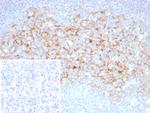 CD23 (Fc Epsilon RII) Antibody in Immunohistochemistry (Paraffin) (IHC (P))