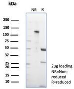 CD23 (Fc Epsilon RII) Antibody in SDS-PAGE (SDS-PAGE)