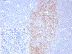 CD23 (Fc Epsilon RII) Antibody in Immunohistochemistry (Paraffin) (IHC (P))