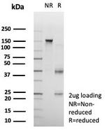 CD23 (Fc Epsilon RII) Antibody in SDS-PAGE (SDS-PAGE)