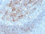 CD23 (Fc Epsilon RII) Antibody in Immunohistochemistry (Paraffin) (IHC (P))