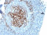 CD23 (Fc Epsilon RII) Antibody in Immunohistochemistry (Paraffin) (IHC (P))