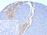 CD64/Fc gamma RI Antibody in Immunohistochemistry (Paraffin) (IHC (P))