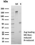 CD64/Fc gamma RI Antibody in SDS-PAGE (SDS-PAGE)