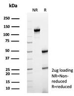 CD64/Fc gamma RI Antibody in SDS-PAGE (SDS-PAGE)