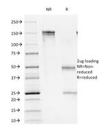 CD16/FcgammaReceptor III Antibody in SDS-PAGE (SDS-PAGE)