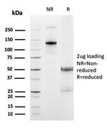 FCGRT/FcRn (IgG Transporter) Antibody in SDS-PAGE (SDS-PAGE)