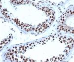 JAZF1 (Transcription Corepressor) Antibody in Immunohistochemistry (Paraffin) (IHC (P))