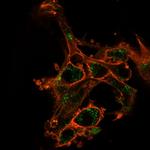 SIRT2 Antibody in Immunocytochemistry (ICC/IF)