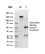 SIRT2 Antibody in SDS-PAGE (SDS-PAGE)