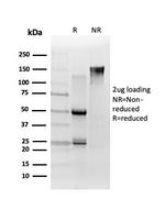 TCF25 Antibody in SDS-PAGE (SDS-PAGE)