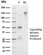 FOXI1/Forkhead Box Protein L1 (Transcription Factor) Antibody in SDS-PAGE (SDS-PAGE)