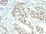 KDM1A (Nuclear Marker and Transcription Factor) Antibody in Immunohistochemistry (Paraffin) (IHC (P))