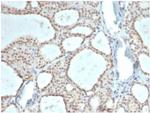 ZHX3 (Transcriptional Repressor) Antibody in Immunohistochemistry (Paraffin) (IHC (P))