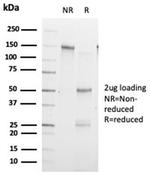 ZHX3 (Transcriptional Repressor) Antibody in SDS-PAGE (SDS-PAGE)