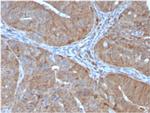 Aldo-keto Reductase Family 1 Member B1 Antibody in Immunohistochemistry (Paraffin) (IHC (P))