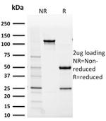 Aldo-keto Reductase Family 1 Member B1 Antibody in SDS-PAGE (SDS-PAGE)