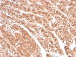 Aldo-keto Reductase Family 1 Member B1 (Adrenal Marker) Antibody in Immunohistochemistry (Paraffin) (IHC (P))