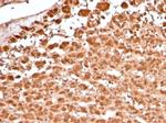 Aldo-keto Reductase Family 1 Member B1 (Adrenal Marker) Antibody in Immunohistochemistry (Paraffin) (IHC (P))