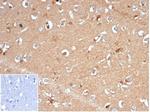 Aldo-keto Reductase Family 1 Member B1 (Adrenal Marker) Antibody in Immunohistochemistry (Paraffin) (IHC (P))