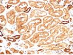 Aldo-keto Reductase Family 1 Member B1 (Adrenal Marker) Antibody in Immunohistochemistry (Paraffin) (IHC (P))