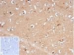 Aldo-keto Reductase Family 1 Member B1 (Adrenal Marker) Antibody in Immunohistochemistry (Paraffin) (IHC (P))