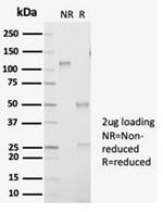 Aldo-keto Reductase Family 1 Member B1 (Adrenal Marker) Antibody in SDS-PAGE (SDS-PAGE)