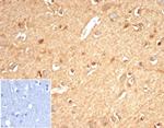 Aldo-keto Reductase Family 1 Member B1 (Adrenal Marker) Antibody in Immunohistochemistry (Paraffin) (IHC (P))